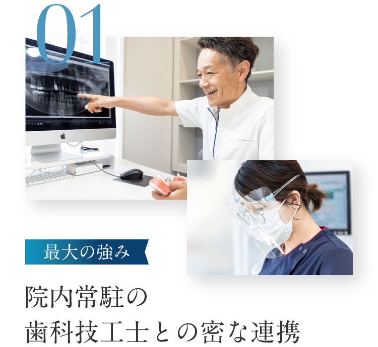 最大の強み 院内常駐の歯科技工士との密な連携